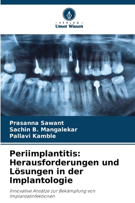 Periimplantitis: Herausforderungen und Lsungen in der Implantologie - Sawant, Prasanna, and Mangalekar, Sachin B, and Kamble, Pallavi