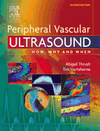 Peripheral Vascular Ultrasound: How, Why and When - Thrush, Abigail, and Hartshorne, Timothy
