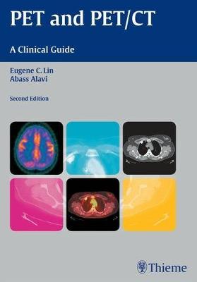 Pet and Pet/CT: A Clinical Guide - Alavi, Abass, MD
