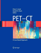 PET-CT: A Case Based Approach
