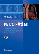 Pet/CT-Atlas: Ein Interdisziplin Rer Leitfaden Der Onkologischen Pet/CT-Diagnostik