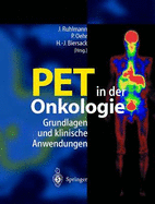 Pet in Der Onkologie: Grundlagen Und Klinische Anwendung