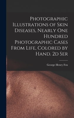 Photographic Illustrations of Skin Diseases, Nearly One Hundred Photographic Cases From Life, Colored by Hand. 2d Ser - Fox, George Henry 1846-1937