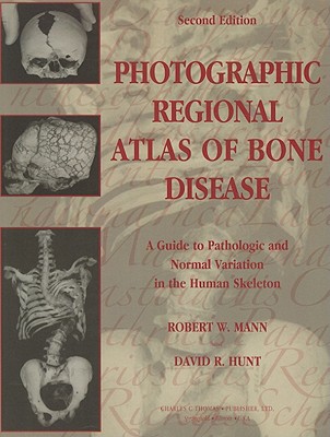 Photographic Regional Atlas of Bone Disease: A Guide to Pathologic and Normal Variation in the Human Skeleton - Mann, Robert W, Dr., and Hunt, David R