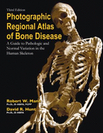 Photographic Regional Atlas of Bone Disease: A Guide to Pathologic and Normal Variation in the Human Skeleton - Mann, Robert W, Dr.