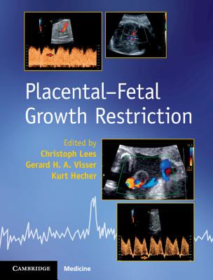 Placental-Fetal Growth Restriction - Lees, Christoph, and Visser, Gerard H. A., and Hecher, Kurt