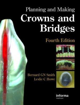 Planning and Making Crowns and Bridges - Smith, Bernard G N, and Howe, Leslie C
