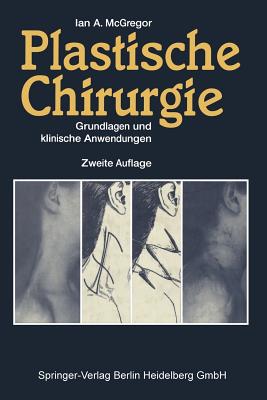 Plastische Chirurgie: Grundlagen Und Klinische Anwendungen - Biemer, E (Translated by), and McGregor, Ian A, and Faust, P (Translated by)
