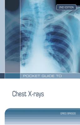 Pocket Guide to Chest X-Rays - Briggs, Greg