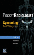 Pocketradiologist - Gynecology: Top 100 Diagnoses