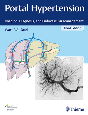 Portal Hypertension: Imaging, Diagnosis, and Endovascular Management - Saad, Wael E a