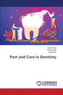 Post and Core in Dentistry
