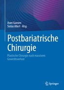 Postbariatrische Chirurgie: Plastische Chirurgie nach massivem Gewichtsverlust