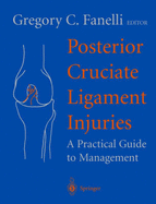 Posterior Cruciate Ligament Injuries: A Practical Guide to Management