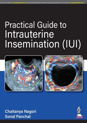 Practical Guide to Intrauterine Insemination (IUI) - Nagori, Chaitanya, and Panchal, Sonal