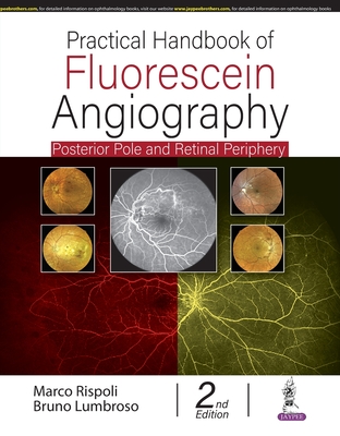 Practical Handbook of Fluorescein Angiography: Posterior Pole and Retinal Periphery - Rispoli, Marco, and Lumbroso, Bruno