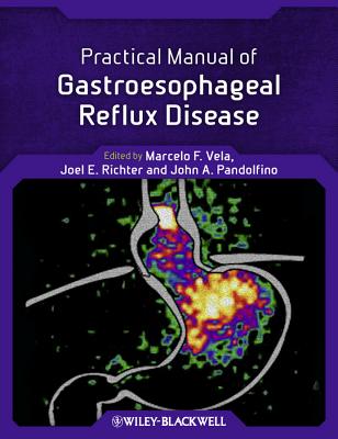 Practical Manual of Gastroesophageal Reflux Disease - Vela, Marcelo F. (Editor), and Richter, Joel E. (Editor), and Pandolfino, John E. (Editor)