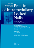 Practice of Intramedullary Locked Nails: Scientific Basis and Standard Techniques Recommended "Association Internationale Pour I'osteosynthese Dynamique" (Aiod)