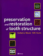 Preservation & Restoration of Tooth Structure