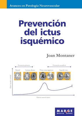 Prevenci?n del ictus isqu?mico - Montaner, Joan