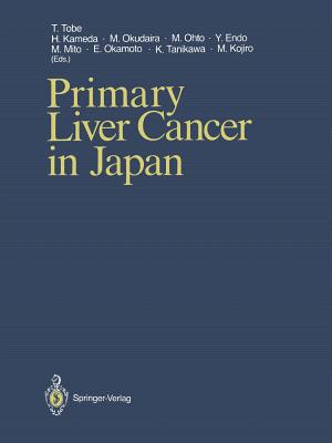 Primary Liver Cancer in Japan - Tobe, Takayoshi (Editor), and Kameda, Haruo (Editor), and Okudaira, Masahiko (Editor)