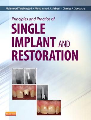 Principles and Practice of Single Implant and Restoration - Torabinejad, Mahmoud, DMD, PhD, and Sabeti, Mohammed, DMD, and Goodacre, Charles, Dds