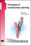 Principles of Carotid Artery Stenting - Mukherjee, Debabrata, and Roffi, Marco, and Abou-Chebl, Alex