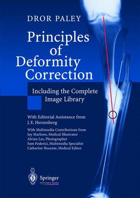 Principles of Deformity Correction - Paley, Dror