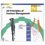 Principles of Fracture Management - Ruedi, and Ruedi, Thomas P, and Murphy, William M