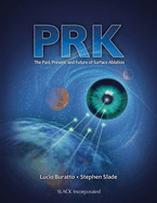PRK: The Past, Present, and Future of Surface Ablation