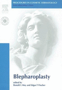 Procedures in Cosmetic Dermatology Series: Blepharoplasty: Text with DVD