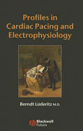 Profiles in Cardiac Pacing and Electrophysiology