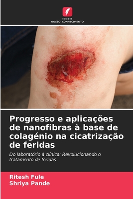 Progresso e aplica??es de nanofibras ? base de colag?nio na cicatriza??o de feridas - Fule, Ritesh, and Pande, Shriya