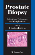 Prostate Biopsy: Indications, Techniques, and Complications - Jones, J Stephen (Editor)