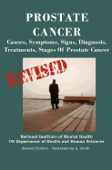 Prostate Cancer: Causes, Symptoms, Signs, Diagnosis, Treatments, Stages. What You Need to Know About Prostate Cancer