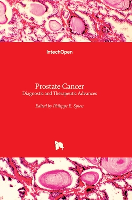 Prostate Cancer: Diagnostic and Therapeutic Advances - Spiess, Philippe E (Editor)