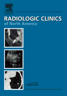 Prostate Imaging, an Issue of Radiologic Clinics: Volume 44-5