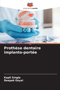 Proth?se dentaire implanto-port?e