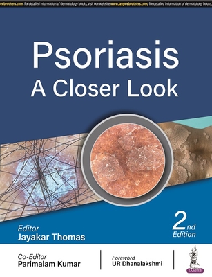 Psoriasis: A Closer Look - Thomas, Jayakar, and Kumar, Parimalam