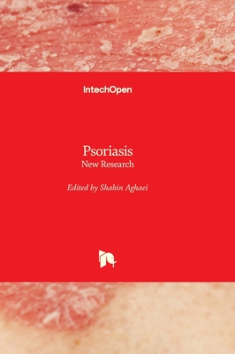 Psoriasis: New Research - Aghaei, Shahin (Editor)