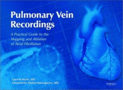 Pulmonary Vein Recordings: A Practical Guide to the Mapping and Ablation of Atrial Fibrillation