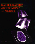Radiographic Assessment for Nurses - Dettenmeier, Patricia A