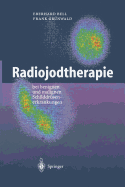 Radiojodtherapie: Bei Benignen Und Malignen Schilddrsenerkrankungen