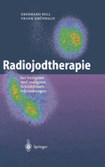 Radiojodtherapie: Bei Benignen Und Malignen Schilddra1/4senerkrankungen