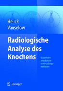 Radiologische Analyse des Knochens: Bestimmung der Mineralkonzentration (Quantitative Physikalische Untersuchungsmethoden)