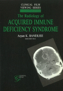 Radiology of Acquired Immune Deficiency Syndrome - Banerjee, Arpan K