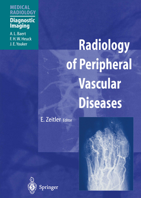 Radiology of Peripheral Vascular Diseases - Zeitler, E (Editor), and Baert, A L (Foreword by)