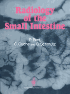 Radiology of the small intestine