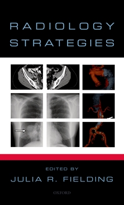 Radiology Strategies - Fielding, Julia (Editor)