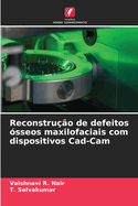 Reconstru??o de defeitos ?sseos maxilofaciais com dispositivos Cad-Cam
